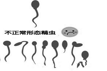 什么是未破裂卵泡黄素化综合征LUFS？LUFS的发病原因有哪些？LUFS患者在生育方面有哪些解决方案