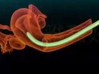 到哪个地方可以做输卵管积水试管，到哪个地方可以做输卵管积水试管手术