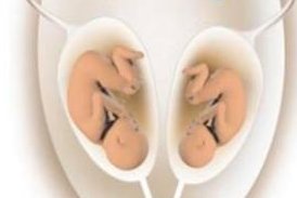 孕妇须知：分娩前一个月，你需要做的3件事，以及4点注意事项